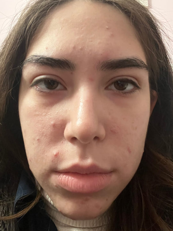 Taylor M. review photo