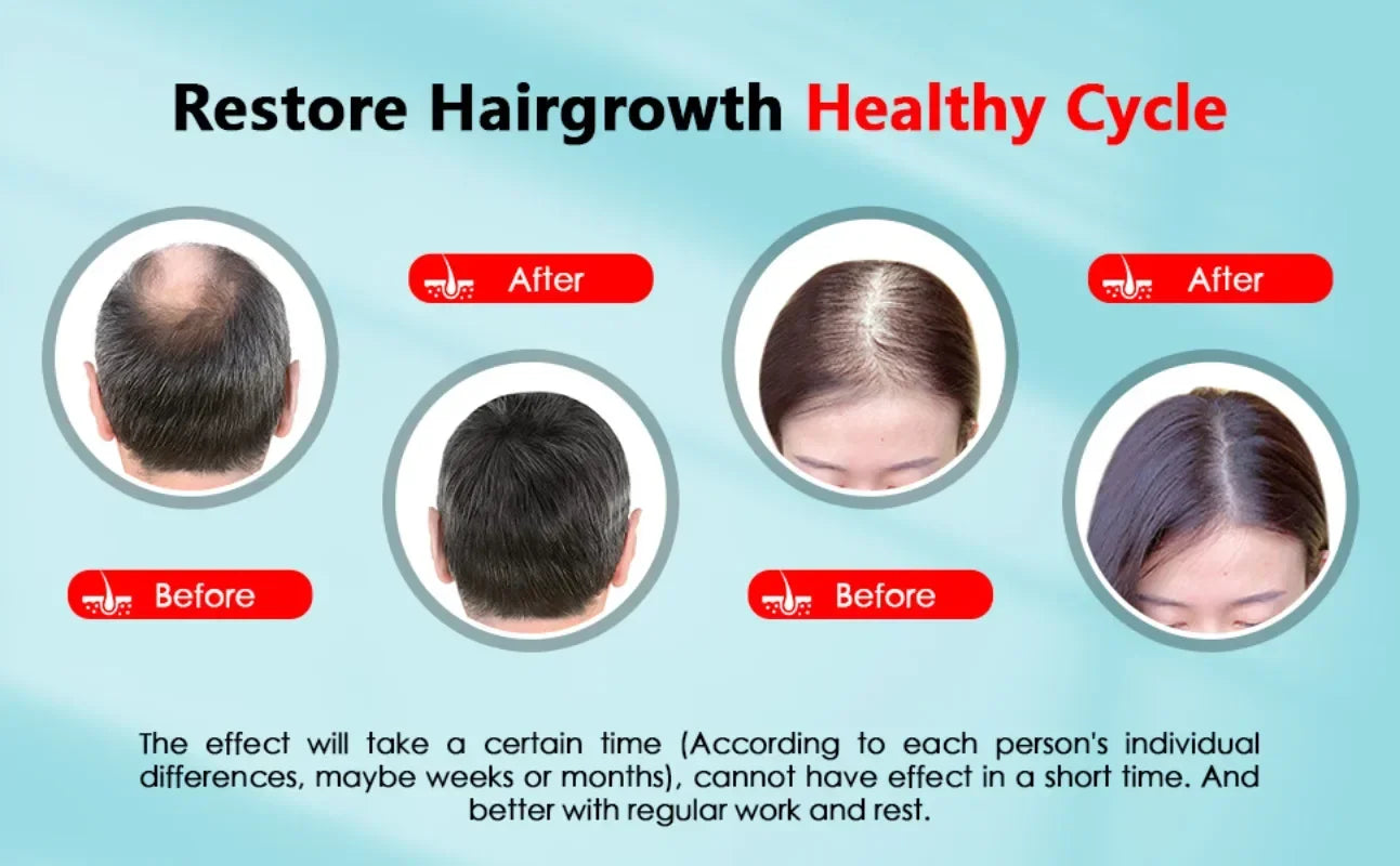 LOXABI™ - HAIR GROWTH CAP